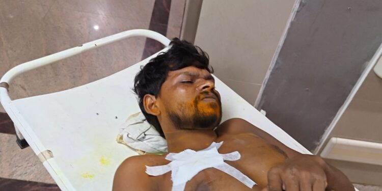 Jamshedpur crime: टेल्को में मामूली कहासुनी में खूनी संघर्ष, मजदूर पर चाकू से हमला, देखिए – video