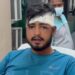 Jamshedpur chapad attack : सिदगोड़ा में युवक पर चापड़ से हमला, युवक गंभीर Jamshedpur chapad attack : सिदगोड़ा में युवक पर चापड़ से हमला, युवक गंभीर