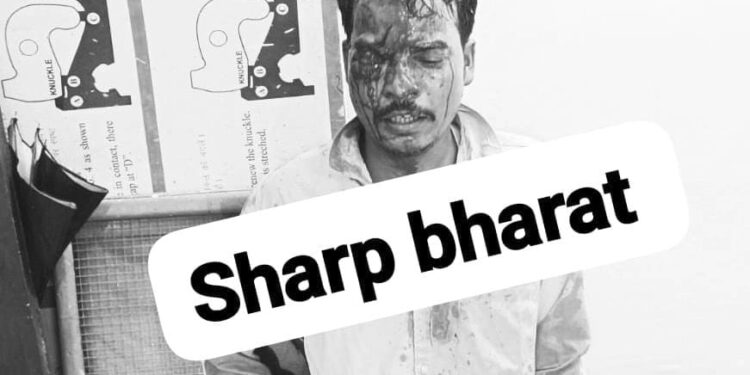 Jamshedpur crime : परसुडीह में ड्यूटी जा रहे रेलवे के कर्मचारी पर कातिलाना हमला, डर का माहौल