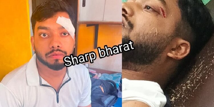 Jamshedpur snatching – सिदगोड़ा में बदमाशों ने स्कूटी सवार भाई-बहन को ओवरटेक कर गिराया, बैग छीनकर भागे, एक को लोगों ने पकड़ा, भाई-बहन घायल, देखिए – video Jamshedpur snatching – सिदगोड़ा में बदमाशों ने स्कूटी सवार भाई-बहन को ओवरटेक कर गिराया, बैग छीनकर भागे, एक को लोगों ने पकड़ा, भाई-बहन घायल, देखिए – video