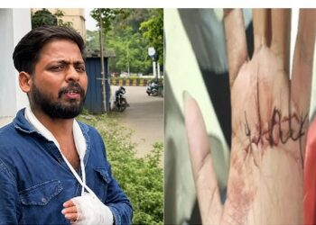 Jamshedpur youth attacked : गोलमुरी में युवक पर तलवार से जानलेवा हमला, हाथ का पंजा कटा, पेट में भी गंभीर चोट