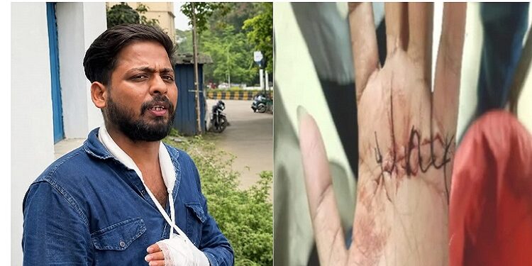Jamshedpur youth attacked : गोलमुरी में युवक पर तलवार से जानलेवा हमला, हाथ का पंजा कटा, पेट में भी गंभीर चोट