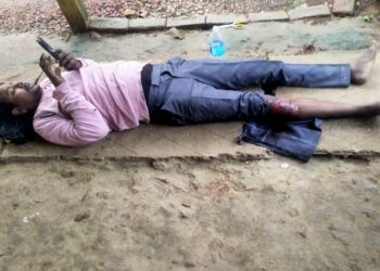Biker injured in road accident : टाटा-पटमदा मार्ग पर बामनी गांव के पास बाइक दुर्घटनाग्रस्त. दिघी बंदिया के जख्मी बाइक सवार का टीएमएच में चल रहा इलाज Biker injured in road accident : टाटा-पटमदा मार्ग पर बामनी गांव के पास बाइक दुर्घटनाग्रस्त. दिघी बंदिया के जख्मी बाइक सवार का टीएमएच में चल रहा इलाज