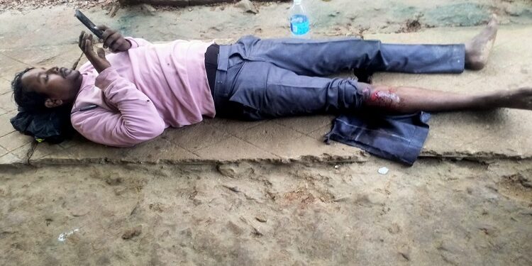Biker injured in road accident : टाटा-पटमदा मार्ग पर बामनी गांव के पास बाइक दुर्घटनाग्रस्त. दिघी बंदिया के जख्मी बाइक सवार का टीएमएच में चल रहा इलाज