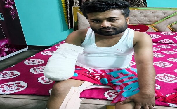 Tata steel incident – टाटा स्टील में ड्यूटी के दौरान हादसा, कर्मचारी का कटा हाथ, गंभीर हालत में टीएमएच के सीसीयू में भर्ती