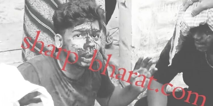 Jamshedpur accident : टेल्को में कार व स्कूटी की टक्कर में दो युवक गंभीर रूप से घायल, चालक पकड़ाया Jamshedpur accident : टेल्को में कार व स्कूटी की टक्कर में दो युवक गंभीर रूप से घायल, चालक पकड़ाया