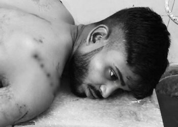 Adityapur weapon attack – आदित्यपुर में शौच के दौरान युवक पर धारदार हथियार से हमला, आरोपी गिरफ्तार