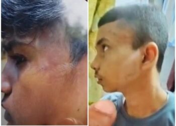 Jamshedpur rural school ragging incident – बहरागोड़ा के जवाहर नवोदय विद्यालय में रैगिंग जैसी घटना, जूनियर छात्रों के साथ मारपीट, अभिभावकों ने की कड़ी कार्रवाई की मांग