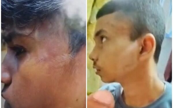 Jamshedpur rural school ragging incident – बहरागोड़ा के जवाहर नवोदय विद्यालय में रैगिंग जैसी घटना, जूनियर छात्रों के साथ मारपीट, अभिभावकों ने की कड़ी कार्रवाई की मांग Jamshedpur rural school ragging incident – बहरागोड़ा के जवाहर नवोदय विद्यालय में रैगिंग जैसी घटना, जूनियर छात्रों के साथ मारपीट, अभिभावकों ने की कड़ी कार्रवाई की मांग