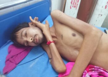 Jamshedpur rural : चाकुलिया का राहुल कई महीने से बीमार, आर्थिक समस्या के कारण नहीं हो पा रहा बेहतर इलाज, मदद की लगाई गुहार Jamshedpur rural : चाकुलिया का राहुल कई महीने से बीमार, आर्थिक समस्या के कारण नहीं हो पा रहा बेहतर इलाज, मदद की लगाई गुहार