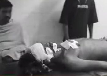Jamshedpur crime : बर्मामाइंस में चापड़बाजी, युवक गंभीर, देखिये – video
