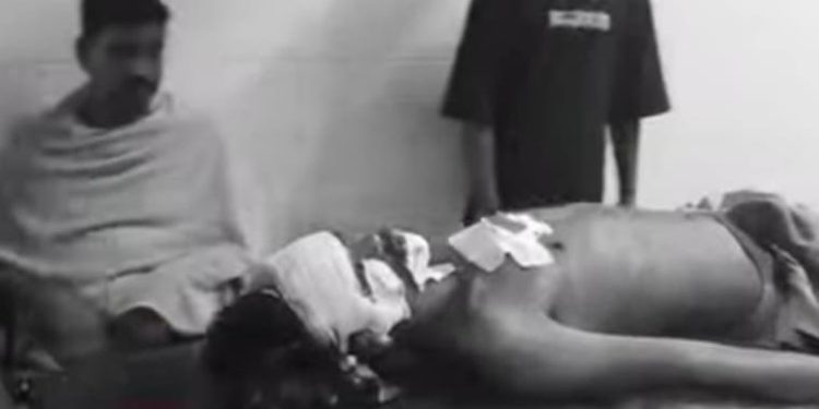 Jamshedpur crime : बर्मामाइंस में चापड़बाजी, युवक गंभीर, देखिये – video Jamshedpur crime : बर्मामाइंस में चापड़बाजी, युवक गंभीर, देखिये – video