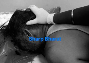 Jamshedpur weapon attack – सिदगोड़ा में आपसी रंजिश में टाटा स्टील के कर्मचारी पर चापड़ से हमला, सिर पर गंभीर चोट, आरोपी साला फरार Jamshedpur weapon attack – सिदगोड़ा में आपसी रंजिश में टाटा स्टील के कर्मचारी पर चापड़ से हमला, सिर पर गंभीर चोट, आरोपी साला फरार