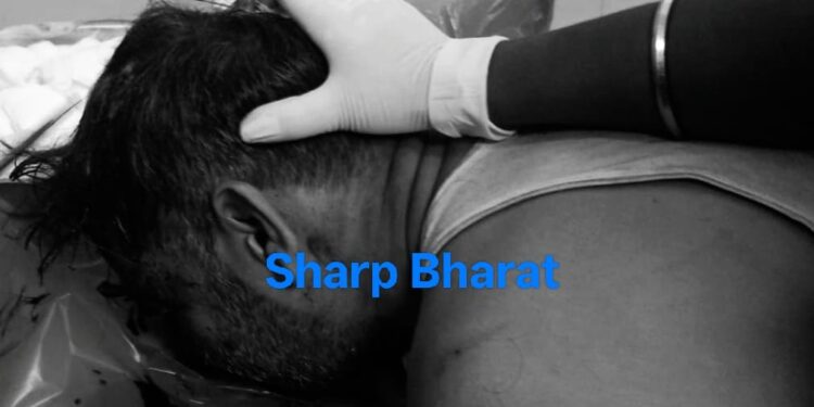 Jamshedpur weapon attack – सिदगोड़ा में आपसी रंजिश में टाटा स्टील के कर्मचारी पर चापड़ से हमला, सिर पर गंभीर चोट, आरोपी साला फरार Jamshedpur weapon attack – सिदगोड़ा में आपसी रंजिश में टाटा स्टील के कर्मचारी पर चापड़ से हमला, सिर पर गंभीर चोट, आरोपी साला फरार