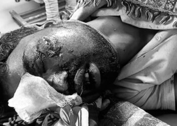 Jamshedpur rural accident case – कमलपुर सड़क दुर्घटना में घायल युवक रिम्स रेफर, इलाज में लापरवाही का आरोप Jamshedpur rural accident case – कमलपुर सड़क दुर्घटना में घायल युवक रिम्स रेफर, इलाज में लापरवाही का आरोप
