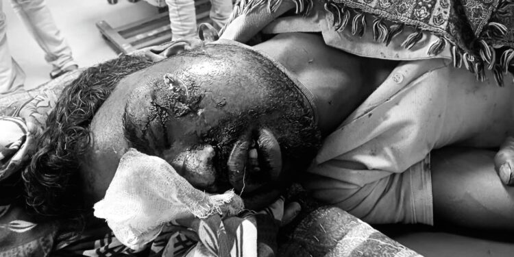 Jamshedpur rural accident case – कमलपुर सड़क दुर्घटना में घायल युवक रिम्स रेफर, इलाज में लापरवाही का आरोप Jamshedpur rural accident case – कमलपुर सड़क दुर्घटना में घायल युवक रिम्स रेफर, इलाज में लापरवाही का आरोप