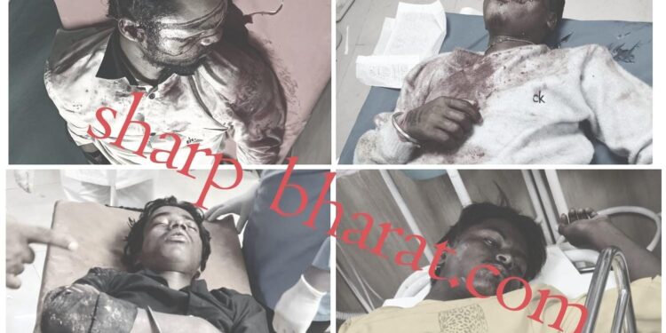 Jamshedpur accident – एमजीएम थाना क्षेत्र का निर्मल चौक-ताता पत्थर बना ब्लैक स्पॉट, सड़क हादसे में एक युवक की मौत, तीन गंभीर Jamshedpur accident – एमजीएम थाना क्षेत्र का निर्मल चौक-ताता पत्थर बना ब्लैक स्पॉट, सड़क हादसे में एक युवक की मौत, तीन गंभीर