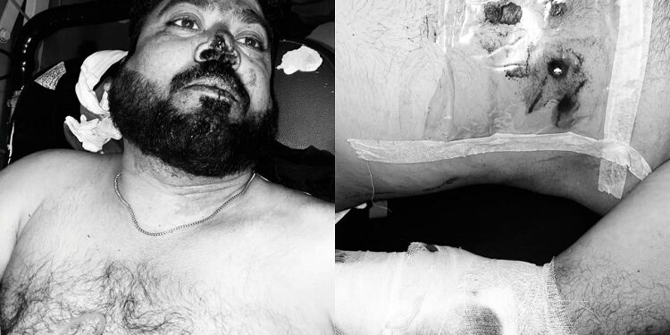 Jamshedpur fir lodged in burmamines firing : बर्मामाइंस आफताब पर जानलेवा हमला मामले में 12 नामजद, पुलिस ने दर्ज की प्राथमिकी Jamshedpur fir lodged in burmamines firing : बर्मामाइंस आफताब पर जानलेवा हमला मामले में 12 नामजद, पुलिस ने दर्ज की प्राथमिकी