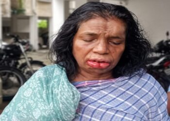 Jamshedpur loot : मानगो श्रीकृष्णा उद्यान में दिनदहाड़े घर में घुस कर लूट, दो महिलाओं व एक पुरुष ने घटना को दिया अंजाम, जेवर एवं अन्य कीमती सामान लूटकर हुए फरार Jamshedpur loot : मानगो श्रीकृष्णा उद्यान में दिनदहाड़े घर में घुस कर लूट, दो महिलाओं व एक पुरुष ने घटना को दिया अंजाम, जेवर एवं अन्य कीमती सामान लूटकर हुए फरार
