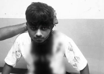 Jamshedpur crime – कदमा में पुराने विवाद को लेकर युवक पर चापड़ से हमला, स्थिति गंभीर, देखिए – video Jamshedpur crime – कदमा में पुराने विवाद को लेकर युवक पर चापड़ से हमला, स्थिति गंभीर, देखिए – video