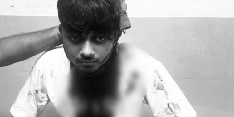 Jamshedpur crime – कदमा में पुराने विवाद को लेकर युवक पर चापड़ से हमला, स्थिति गंभीर, देखिए – video Jamshedpur crime – कदमा में पुराने विवाद को लेकर युवक पर चापड़ से हमला, स्थिति गंभीर, देखिए – video