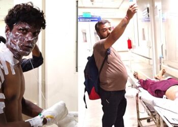 Jamshedpur incident : कदमा में गैस कनेक्शन लगाने के दौरान झुलसे दो मजदूर, एक गंभीर